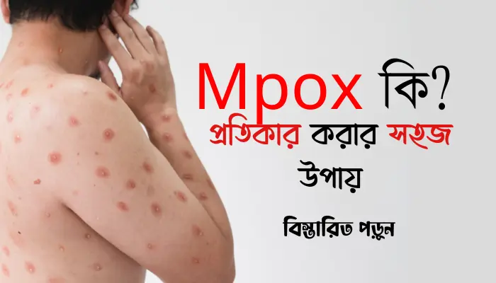 Mpox কি? এম পক্স কিভাবে ছড়ায়? প্রতিকার করার সহজ উপায়